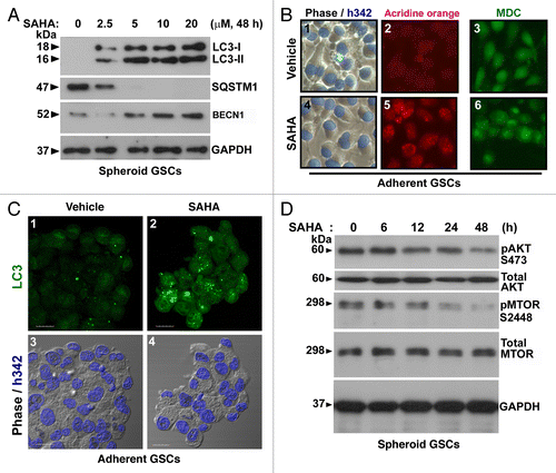 Figure 4. SAHA triggered autophagy flux in GSCs. (A) Conversions of LC3-I to LC3-II and the protein levels of BECN1 and SQSTM1 were determined by western blotting after spheroid GSCs (5 × 105 cells/ 60 mm dish) treated with various concentration (0, 2.5, 5, 10 and 20 μM) of SAHA for 48 h. GAPDH was a loading control. (B) Following above experimental conditions, micrographs showed the appearance of vesicular organelles in the adherent GSCs (phase contrast; blue fluorescence: Hoechst33342 staining as nuclear; B-1, B-4). AVOs induced by 5 μM SAHA were stained with acridine orange (red fluorescence: AVOs; B-5) and 0.05 mM MDC (green fluorescence; B-6). (C) Adherent GSCs were treated with the presence or absence (vehicle control) of the HDAC inhibitor, SAHA, at 5 μM for 48 h, and then stained with LC3 antibody and Hoechst 33342. Immunocytochemical detection of endogenous levels for LC3 (green fluorescence) was visualized on confocal microscope (C-1, C-2). Bottom panels (C-3, C-4) were merged with Hoechst 33342 (blue fluorescence, nuclei) and phase contrast (original magnification, ×1200; scale bars: 20 μm). (D) Time-dependent (0, 6, 12, 24 and 48 h) increase in dephosphorylation of endogenous AKTt and MTOR following SAHA (5 μM) treatment. Each protein was determined on western blot using a specific antibody or phospho-specific antibody as indicated on the left side of each strip. GAPDH protein levels serve as loading controls. Each square represents 100 × 100 μm in (B).