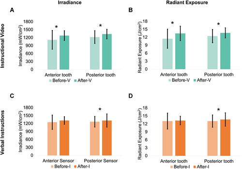 Figure 5 Comparison between the mean irradiance (mW/cm2) and radiant exposure (J/cm2) values before and after the instructional video (V) and verbal instructional (I) methods using the anterior and posterior teeth on the Managing Accurate Resin Curing-Patient Simulator (MARC-PS) system. (A) Irradiance values before- and after-V. (B) Radiant exposure values before- and after-V. (C) Irradiance values before- and after-I. (D) Radiant exposure values before- and after-I. Asterisk *represents significant differences between before- and after- each instructional method when curing each tooth.