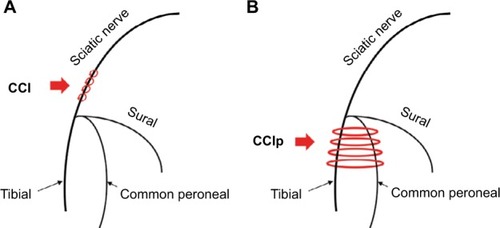 Figure 1 Schematic diagram of surgical ligation site in CCI and CCIp rats.Notes: (A) Four ligatures were tied around the sciatic nerve trunk with ~1 mm space between ligatures in CCI rats. (B) Four ligatures were tied loosely around the tibial nerve and the common peroneal nerve in CCIp rats.