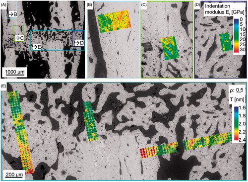Figure 5. Results from nanoindentation and synchrotron small angle X-ray scattering experiments (SAXS). Panel A shows a backscattered electron image (compare Figure 1E) of a non-critical-size femoral osteotomy, six weeks post-osteotomy. The four colored boxes refer to the analyzed areas in panels B to E, which are shown in higher resolution. Panel B to D visualize nanoindentation measurement results showing the indentation modulus E r color-coded. Panel E demonstrates small angle X-ray scattering results giving the degree of orientation (ρ parameter) and the predominant orientation (bar-coded by length and orientation) as well as the mean thickness (T parameter) of the mineral particles (color-coded).