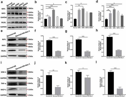 Figure 4. The effect of HR treatment on the necroptosis-associated proteins of HK-2 cells. Western blotting (a) and quantitative data on the necroptosis-associated proteins RIP1 (b), RIP3 (c) and MLKL (d). Western blotting (e) and quantitative data on the necroptosis-associated proteins RIP1 (f), RIPK3 (g) and MLKL (h). Western blotting (i)and quantitative data on KIM-1 (j) and the inflammation-associated cytokines TNF-α (k) and MCP-1 (l). Data represent the mean ± standard deviation of at least three independent experiments, *P < 0.05, **P < 0.01, ***P < 0.001.