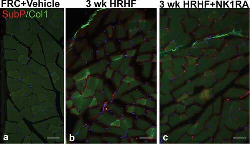 Figure 4. Representative images of Collagen type 1 (green) and Substance P (red) immunoreactivity in cross-sectionally cut flexor digitorum muscles of FRC+Vehicle, untreated 3-week HRHF, and 3-week HRHF+NK1RA rats. DAPI used as a nuclear counterstain. Representative images are shown for: (a) FRC+Vehicle rat; (b) 3 week HRHF rat; and (c) 3 week HRHF + NK1RA rat. A representative image for the FRC+Vehicle group only is shown as no differences were observed between the FRC+Vehicle and FRC+NK1RA groups. Scale bars = 50 µm.