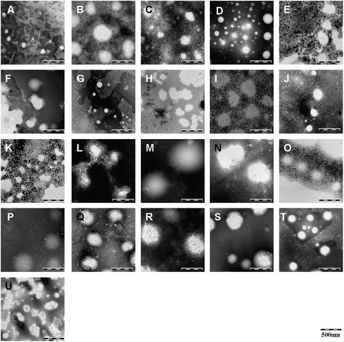 Figure 1. Morphological characteristics of SN-38 NPs containing mPEG2000-PCL1140 (A), mPEG2000-PCL2000 (B), mPEG2000-PCL4000 (C), mPEG2000-PCL5300 (D), mPEG2000-PCL6000 (E), mPEG2000-PCL8000 (F), mPEG5000-PCL1000 (G), mPEG5000-PCL2000 (H), mPEG5000-PCL4000 (I), mPEG5000-PCL5000 (J), mPEG5000-PCL10000 (K), mPEG5000-PCL15000 (L), mPEG2000-PLGA2000 (M), mPEG2000-PLGA4000 (N), mPEG2000-PLGA5000 (O), mPEG5000-PLGA1000 (P), mPEG5000-PLGA2000 (Q), mPEG5000-PLGA4000 (R), mPEG5000-PLGA5000 (S), mPEG5000-PLGA10000 (T), and mPEG5000-PLGA20000 (U), respectively.