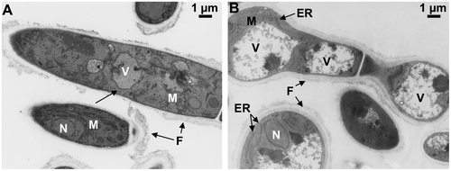 Fig. 10. TEM observation of T. reesei QM9414 and PC-3-7.