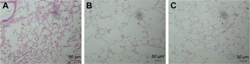 Figure 5 Histomorphological changes in lung tissue.Notes: Lung tissue in the CSE group (B) exhibited enlarged alveolar space, thinner alveolar septum, and destroyed alveolar wall when compared with controls (A). Lung tissue in the CSE + 5-Aza-CdR group (C) also exhibited enlarged alveolar space, but smaller than that of the CSE group. Magnification ×100.Abbreviations: CSE, cigarette-smoke extract; 5-Aza-CdR, 5-Aza-2′-deoxycytidine.