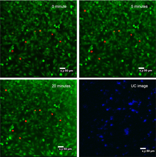 Figure S4 Effect of 980 nm irradiation with 50 mg mL−1 UCN-SIO2 nanoparticles.Notes: Confocal image of MCF-7 cells stained with fluorescein diacetate/propidium iodide exposed under 980 nm irradiation for up to 20 minutes as negative controls.Abbreviation: UC, upconversion.