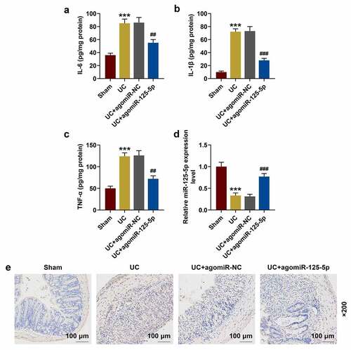 Figure 7. MiR-125-5p agomiR affects the expression of inflammatory factors, miR-125-5p and IL-6 R in ulcerative colitis (UC) mouse model. (a-c) The expression of interleukin-6 (IL-6), IL-1β and tumor necrosis factor-α (TNF-α) in the colon tissue homogenates of mice in the Sham, UC, UC + agomiR-NC, and UC + agomiR-125-5 groups was measured using enzyme-linked immunosorbent assay (ELISA). (d) The expression of miR-125-5p in the colon tissues of each group of mice was detected by reverse transcription real-time quantitative polymerase chain reaction (RT-qPCR). (e) The expression of IL-6 R in colon tissues of mice in each group was detected by immunohistochemistry. Magnification × 200, Scale = 100 μm. All experiments have been performed in triplicate. *** P < 0.001 vs. Sham; ## P < 0.01, ### P < 0.001 vs. UC + agomiR-NC