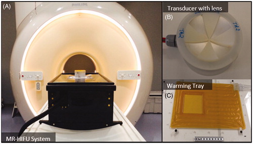 Figure 1. Components of an MRI-compatible focused ultrasound system used to generate hyperthermia exposures in preclinical experiments. A) The MRI-compatible positioning system is positioned on the patient table of a clinical MR scanner. B) A focused transducer with a 3D-printed acoustic lens. C) Warming tray used to maintain the body temperature of the animal.
