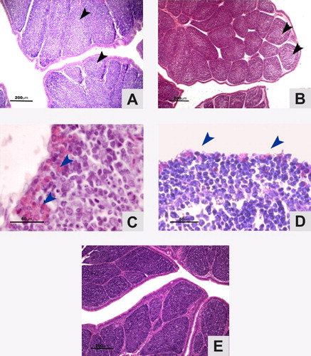 Figure 2. Photomicrographs of tissue lesions in the bursae of birds vaccinated against IBDV (H&E stain). Plicae showing lymphocyte depletion areas (arrow) after vaccination with ST-14 (A) and Lukert (B) strains at 21st day P.I. (Scale bars = 200 µm). IR with infiltrates of heterophils. (arrows) ST-14 (C) and Lukert (D) strains at 28th day P.I. (Scale bars = 50 µm). (E).Control at 21st day P.I. (Scale bar = 200 µm).