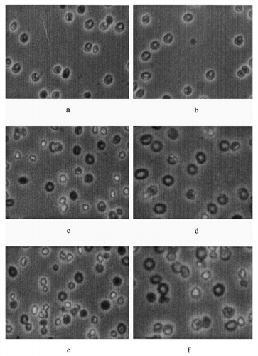 Figure 3. The shape of erythrocyte samples (3a-1mg/ml catalase, 3b-1mg/ml PEGcatalase, 3c-2mg/ml catalase, 3d-1.9mg/ml PEGcatalase, 3e-5mg/ml catalase; magnification 3.3 × 10).