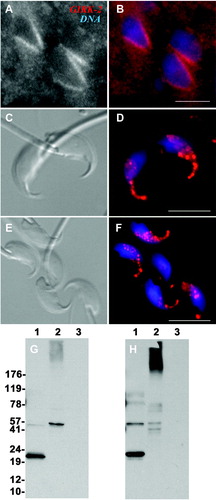 Figure 3.  Immunolocalization of GIRK2 K+ ion channels to the manchette of mouse spermatids and the acrosomal region of mouse spermatozoa. GIRK2 labeling in the caudal manchette of mouse elongating spermatids was performed on paraffin testicular tissue sections (A, B). Mouse sperm heads with acrosomes as shown by differential interference contrast (DIC) light microscopy (C, E), and corresponding epifluorescence microscopy (D, F) of GIRK2 protein (red) and DNA stain DAPI (blue). Grayscale (A) and pseudo-colored, (B; GIRK2 = red; DNA = blue) views are shown. G, H) Western blot analysis. Lane 1: mouse sperm (30 µg/lane), 2: pig brain tissue (30 µg/lane), and 3: loading buffer. Membranes were incubated with rabbit polyclonal anti-GIRK2 antibodies from Alomone lab (Jerusalem, Israel) (G) and Chemicon International Inc. (Temecula, CA, USA) (H), respectively.