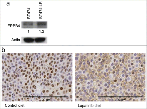 Figure 3. ERBB4 protein levels are modestly up-regulated in lapatinib-resistant cells, compared to sensitive cells. (a) ERBB4 expression in BT474 and BT474-LR cells were analyzed by protein gel blot with anti-ErbB4 (Ab5721) and actin antibodies. (b) Six to 12 month old MMTV-Neu female mice with mammary tumors (volume 200 mm3) were fed with control or lapatinib-containing diet (200 mg/kg) for 3 to 8 weeks until tumors reach 1000 mm3. Tumors were harvested and stained with the rabbit monoclonal anti-HER4/ErbB4 antibody (clone E200). Six out of 14 tumors from control mice exhibited no membranous ErbB4 staining (left). All (13/13) tumors from lapatinib-treated mice expressed ErbB4 on the plasma membrane (right).