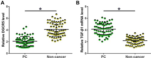 Figure 1 DGCR5 and TGF-β1 were dysregulated in PC tissues. Comparisons of RT-qPCR data by paired t-test revealed that DGCR5 was significantly down-regulated (A), while TGF-β1 was significantly up-regulated (B) in PC tissues than in non-cancer tissues of PC patients. All PCR reactions were repeated 3 times and mean values were presented and compared by paired t-test (*p<0.05).