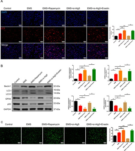 Figure 4. Autophagy-dependent ferroptosis is involved in EMS cells. (A) Expression of the LC3 in cells was tested by IF (magnification 200×, scale bar: 100 μm), and the chart was calculated. n = 3 in each group. (B) Expression of the Beclin1, LC3 II/LC3 I, GPX4, and p53 was tested by western blot. n = 3 in each group. (C) MDC staining was used to test the autophagy particle of cells in each group. n = 3 in each group. ##p < 0.01 vs. control group. @p < .05 and @@p < .01 vs. EMS group. $$p < .01 vs. EMS + si-Atg5 group. EMS: endometriosis; GPX4: glutathione peroxidase 4; IF: immunofluorescence; MDC staining: monodansylcadaverine staining.