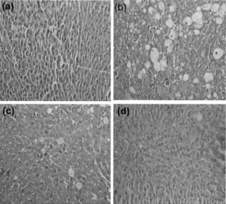 Figure 3 Hepatoprotective activity of ethyl acetate extract (EtOAc) of P. rimosus. against CCl4-induced chronic hepatotoxicity in rats. Liver sections stained with H&E. (a) Normal; (b) CCl4/paraffin oil; (c) EtOAc (25 mg/kg body wt.) + CCl4;; (d) EtOAc (50 mg/kg body wt.) + CCl4. Magnification, × 20.