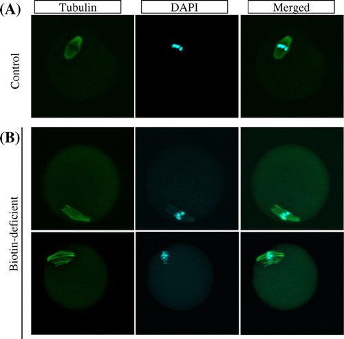 Fig. 1. Spindle abnormalities in oocytes induced by biotin deficiency.Notes: Representative examples of meiotic spindles in oocytes from indicated mice (n  = 37–38 oocytes analyzed per group) after labeling α-tubulin antibody (green) and counter-staining DNA with DAPI (aqua blue). (A) control group, (B) biotin-deficient group.