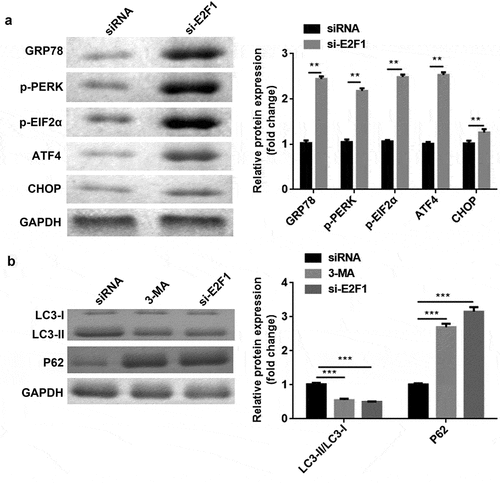 Figure 6. E2F1 knockdown modulated ERS and autophagy. (a) Protein levels of ERS markers were measured by western blotting. (b) The expression levels of autophagy markers were measured using western blotting. **P < 0.01. ***P < 0.001.