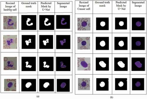 Figure 4. Segmentation of nucleus by U-Net: (a) healthy cells and (b) blast cells.