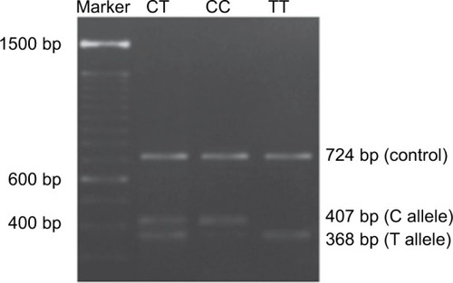 Figure 1 Visualization of the DNMT3A rs11683424 polymorphism using agarose gel electrophoresis.