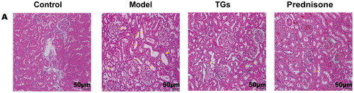 Figure 2. TGs protect against alterations in the kidney architecture of NS. HE staining (n = 3; scale bar: 50 µm). Yellow arrows indicate brush border detachment and absence. Blue arrows indicate protein casts. Yellow triangles indicate focal inflammatory cell infiltration.