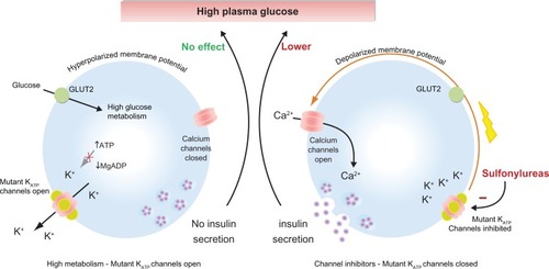 Figure 3 Sulfonylureas stimulate insulin secretion in neonatal diabetes caused by KATP channel mutations. (Left) Activation mutations in the KATP channel prevent channel closure in response to high plasma glucose. Consequently, the membrane potential remains hyperpolarized even, thereby preventing insulin secretion. (Right) Sulfonylureas bind directly to KATP channels causing channel inhibition that triggers membrane potential and insulin secretion resulting in a lowering of plasma glucose.