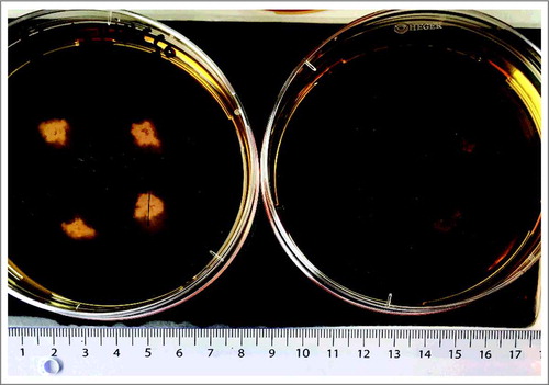 Figure 7. Images of soft BHI agar motility plates. Each plate has four zones of motility from isolate AAUH_14HCco. Plate 1: Microaerophilic growth; Plate 2 anaerobic growth. Circles indicate motility zones with a diameter line.