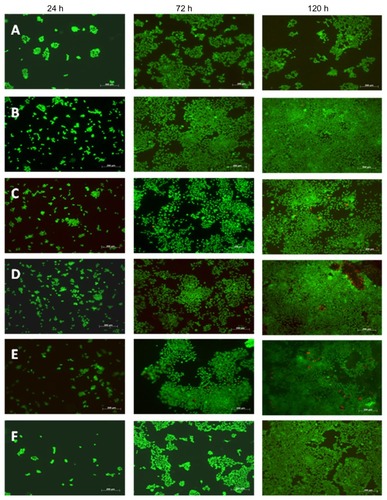 Figure 7 Live/Dead® assay images after 24, 72, and 120 hours on the various weight ratios (A) 100:0, (B) 75:25, (C) 50:50, (D) 25:75, (E) 0:100, and (F) glass with a PLGA density of 0.025 g/mL.Note: Green indicates live cells and red indicates dead cells. Seeding density was 5.5 × 104 cells/mL. Scale bar 200 μm.Abbreviation: PLGA, poly(lactic-co-glycolic-acid).