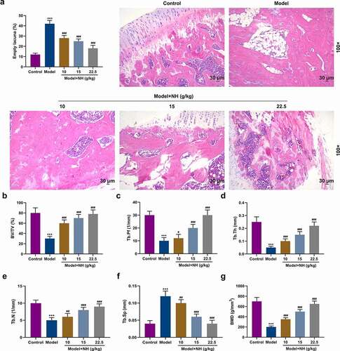 Figure 1. NH treatment reduced the histopathological changes of the SONFH mice and improved the structure of the femoral head. (a) HE staining was used to observe the effects of different concentrations of NH (10, 15, and 22.5 g/kg/d) on the pathological changes of femurs. Magnification, 100×; Scale bar = 30 µm. (b) Changes in femoral head tissue and trabecular bone were detected using μ-CT. The bone volume fraction (BV/TV) was calculated after SONFH mice treated with NH. (c) The trabecular bone morphology factor (Tb.Pf) was calculated after SONFH mice treated with NH. (d) The trabecular thickness (Tb.Th) was calculated after SONFH mice treated with NH. (e) The trabecular bone number (Tb.N) was calculated after SONFH mice treated with NH. (f) The trabecular spacing (Tb.Sp) was calculated after SONFH mice treated with NH. (g) The bone mineral density (BMD) was calculated after SONFH mice treated with NH. SONFH: steroid-induced femoral head necrosis; NH: Neohesperidin; ***P < 0.001 vs. control; #P< 0.05, ##P< 0.01, ###P< 0.001 vs. model).