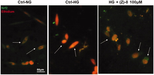 Figure 6. Antioxidant activity of compound (Z)-8. The micrograph obtained with the florescence microscope showed the specific staining for Nrf2 (green) and the nuclear staining obtained with ethidium bromide (red). The arrows indicate the different localisation of Nrf2, cytosolic in both normoglycemic conditions and after the treatment with 100 µM (Z)-8, while it is nuclear (yellow-orange marking, co-localisation) in hyperglycaemic conditions.