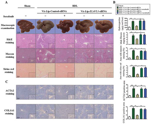 Figure 6. Sorafenib treatment alleviates murine liver fibrosis by inducing HSC ferroptosis. Fifty mice were randomly divided into 5 groups of 10 animals each with comparable mean body weight. Mice of 5 groups were treated with Sham, BDL+ VA-Lip-Control-siRNA, BDL+ VA-Lip-Control-siRNA+ sorafenib, BDL+ VA- Lip-ELAVL1-siRNA, or BDL+ VA-Lip-ELAVL1-siRNA+ sorafenib. (a and b) The pathological changes of the livers were observed by macroscopic examination. Scale bars: 1 cm. Representative photographs were shown. Thin sections (4 μm) were stained with H&E, Sirius Red, and Masson for histopathological study. The liver fibrosis stage was assessed by Ishak scale. Liver hydroxyproline level was determined using the Hydroxyproline Assay Kit (n = 6 in every group, *, p < 0.05, **, p < 0.01). (c) Immunohistochemical staining of ACTA2 and COL1A1 was determined. Scale bars: 50 μm. Representative photographs were shown (n = 6 in every group, *, p < 0.05, **, p < 0.01, ***, p < 0.001).