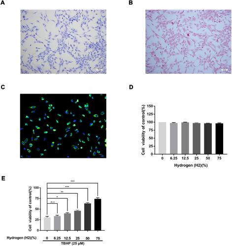 Figure 3 Effect of H2 on human chondrocyte viability. Chondrocytes were stained by toluidine blue, and proteoglycans in chondrocytes were stained purple (n = 3) (A). Safranin O staining of human primary chondrocytes (n = 3) (B). Collagen II immunofluorescence staining of human primary chondrocytes (n = 3) (C). The cytotoxicity and the cell viability of H2 on the TBHP-induced chondrocytes by using the CCK-8 assay (n = 3, 24 h) (D and E). All data are presented as mean ±SEM. *P < 0.05, **P < 0.01, ***P < 0.001, vs the control group, n = 3.