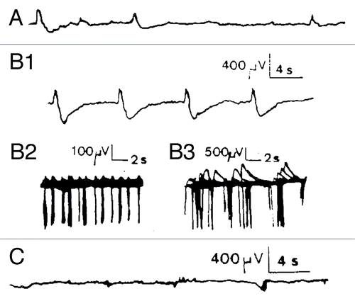 Figure 2. Chemical activation of Kalanchoë Daigremontiana stem tissues. (A) recording of spontaneous spikelets 5 min before FC activation. FC activation responses occurred 7 min after the local FC deposition (3.7 µM, n = 4) between both recording electrodes as trains of −/+ spikes in which the rising phase is 1/3 of the descending one (B1 and B2). This corresponds to classical hyperpolarizations observed in mammalian cells linked to calcium dependent K+ conductance. AP duration ranged from 300–500 msec for the fastest, and up to 2 sec for the slowest, with maximal amplitudes of 3 mV, and separation intervals from 2–16 sec Return to the baseline ranged from 0.25–2.5 sec depending on the duration of the repolarizing phase. The total duration of this burst was 27 min and it was immediately interrupted by application of FCCP 50 µM at the same site (C1, n = 2). However, no restoration was seen, even after 2 h recording, which was not the case for other metabolic inhibitors like 2–4-DNP (100 µM) or low temperature (0°C) that show partial or total recovery, possibly due to the capacity of the tissue to more easily recover from a block of ATP (not shown). Concerning the Material and Methods (electrophysiological set-up, soil culture conditions, temperature and humidity %, stimulating procedure, elimination of interference signals by Faraday cage, correlated methods, use of several kind of electrodes including Ag-AgCl probes, controls made with salt bridges during several hours etc...), please refer to Debono and Bouteau (1992) referenced in Citation9.