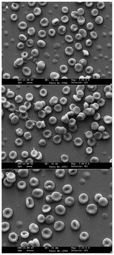 Figure 8. SEM of red blood cells exposed to (a) untreated control (b) Triton X-100 (c) nanoemulsion concentration of 5 µg/mL for1 h.