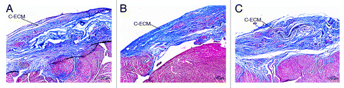 Figure 4. Histological examination of C-ECM patches using Masson’s Trichrome. The patches are incorporated into the native tissue by 4 weeks (A). The scaffold was also easily observed at 8 weeks (B) and 16 weeks (C) with a similar thickness as the surrounding ventricular wall and little evidence of remodeling. Scale indicates 100 µm.