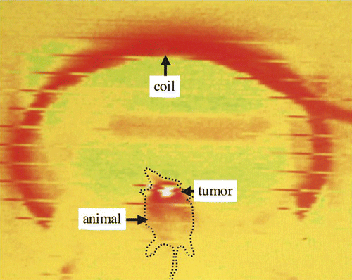 Figure 6. Monitoring of skin temperature during treatment by infrared thermometer shows a selective temperature elevation.