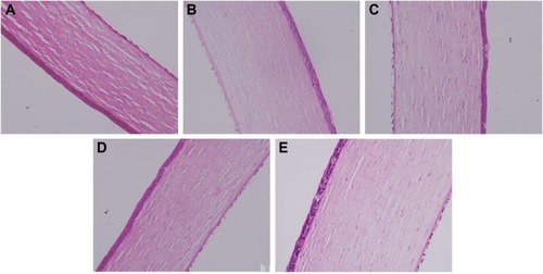Figure 12 Cornea histopathology by microscopy.Notes: (A) Normal cornea, (B) treated with saline, (C) treated with Betoptic, (D) treated with BH solution, and (E) treated with Mt-BH-LPs.Abbreviations: Mt-BH-LPs, montmorillonite–betaxolol hydrochloride liposomes; BH, betaxolol hydrochloride.