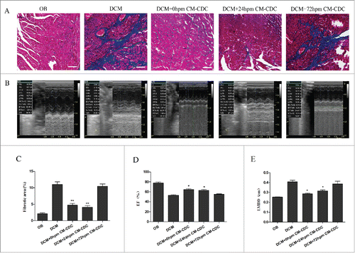 Figure 6. CDCs transplantation reduce collagen mass and improve cardiac function. (A) Masson's trichrome staining for cardiac fibrosis evaluation. (B) Representative images of LV M-mode echocardiograms 8 weeks after CM-CDCs transplantation. (D and E) Changes in ejection fraction (EF) and LV internal diastolic diameter (LVIDD) after CM-CDCs or PBS treatment, n = 10 in PBS groups, n = 8 in CM-CDCs-treated groups. Scale bar = 50 µm. Data are shown as the mean ± SEM. *p < 0.05 vs. DCM+PBS treated group. (C) Myocardial fibrosis was evidently reduced in the 0 h CM-CDC-treated and 24 h CM-CDC-treated groups compared to the PBS-treated group; however, fibrosis in the 72 h CM-CDC-treated mice was similar to that in the PBS-treated mice.