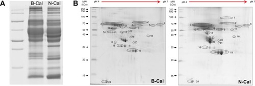 Figure 2 Plasma protein binding profiles of calcium carbonates separated by one-dimensional (A), and two-dimensional (B), gel electrophoresis.Abbreviations: B-Cal, bulk calcium carbonates; N-Cal, nano calcium carbonates.