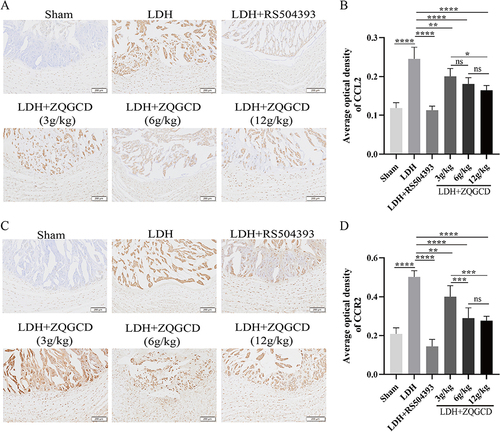 Figure 8 The expression of CCL2/CCR2 pathway in the intervertebral disc of LDH rats was increased, but CCR2 inhibitors or ZQGCD inhibited this expression. (A and B) Representative images (magnification: 40x) and semi-quantitative histogram of immunohistochemical staining of CCL2 protein of intervertebral disc. (C and D) Representative images (magnification: 40x) and semi-quantitative histogram of immunohistochemical staining of CCR2 protein of intervertebral disc. *P<0.05, **P<0.01, ***P<0.001, ****P<0.0001, ns: P>0.05.