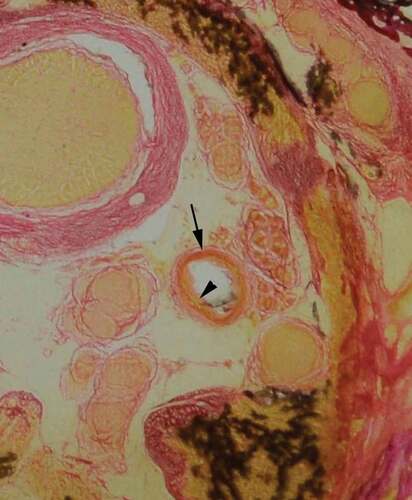 Figure 4. Identification of arterial wall tunics. Gomori’s trichrome stain, provided good differentiation, enabling identification of the tunica adventitia (arrow) and tunica media (arrowhead)