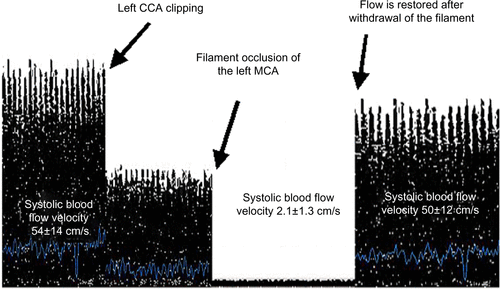 Figure S1 The basic parameters of cerebral blood flow during all phases of rat stroke modeling.Abbreviations: CCA, common carotid artery; MCA, middle cerebral artery.