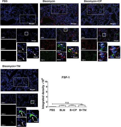 Figure 6. The Tocilizumab mimotopes did not increase the expression of FSP-1 in the whole lung tissues the tissue sections were incubated with anti-sca-1 and anti-FSP-1 antibody and followed by Alexa Fluor 488 and 594-conjugated secondary antibody. Representative images were captured with a microscope (×200–400 magnification, presented bar: 50–20 μm). Each image of immunofluorescence was acquired at the same adjustment parameters. Red (SCA-1): black (40.0) gamma (0.1) white (65.0). Green (FSP-1): black (25.0) gamma (0.5) white (65.0). The results showed that immunization with the Tocilizumab mimotopes did not increase the expression of FSP-1 in the whole lung tissues, including the fibroblasts in BLM-induced model. (Representative image, n = 6 mice per group. Mean ± SEM; ***p < .001; **p < .005; *p < .05; n.s. non-significant; Representative image, n = 6 mice per group).