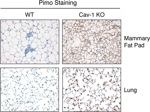 Figure 13 Cav-1 gene deletion in mice induces a pseudo-hypoxic phenotype. To monitor hypoxia signaling in vivo, the hypoxia marker pimonidazole was injected in the tail vein of WT and Cav-1 (−/−) null mice. One hour post-injection, mice were sacrificed and the mammary glands and lungs were collected. Paraffin-embedded sections of mammary gland and lung were immuno-stained using a rabbit antiserum to pimonidazole. Slides were counter-stained with hematoxylin. Note that both the mammary fat pads and the lung parenchyma of Cav-1 (−/−) null mice display strong anti-pimonidazole staining. These data suggest that Cav-1 (−/−) mice undergo pseudo-hypoxic stress at steady-state. Original magnification, 40x.