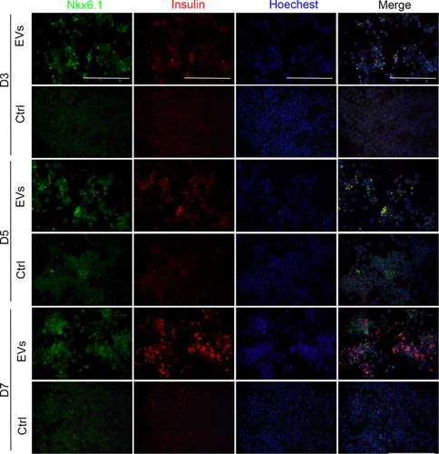 Figure 4 Immunofluorescence assays for Nkx6.1 and insulin expression. Representative images of co-immunostaining of Nkx6.1 (green) and insulin (red), nuclear Hoechst staining is shown in blue, scale bar = 50μm.