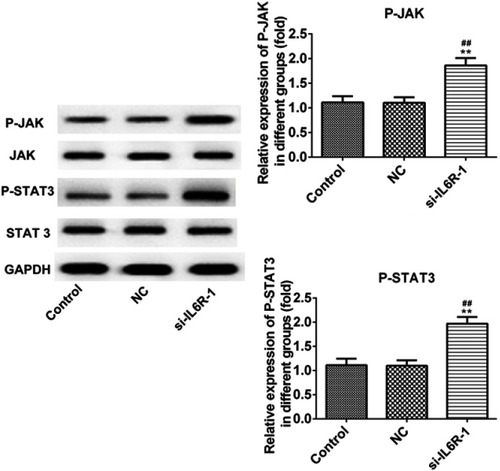 Figure 8 IL-6R inhibition promotes the viability and inhibits apoptosis of INS-1E cells through JAK/STAT signaling pathway. **P<0.01 vs control group. ##P<0.01 vs NC group.