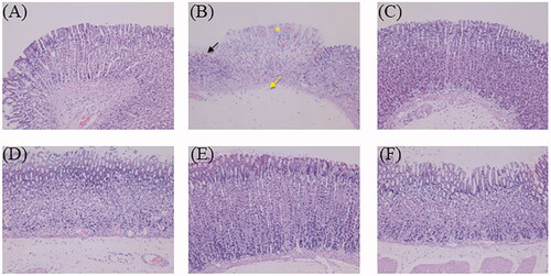 Figure 10. The haematoxylin and eosin-stained gastric tissue micrographs (400× magnification): (A) normal control group, (B) ulcer control group (star: necrotic area of gastric mucosa, yellow arrow: oedema of the submucosa, black arrow: haemorrhagic patches), (C) omeprazole group, (D) low dose of ZJP group; (E) medium dose of ZJP group; (F) high dose of ZJP group.