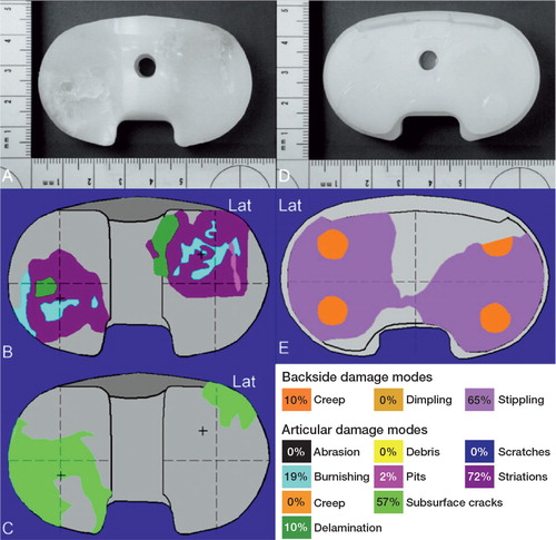 Figure 3. Macroscopic photos, damage patterns, and damage modes on the articular surface (panels A–C) and backside surface (panels D and E) of the right insert.