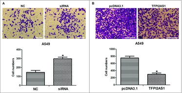 Figure 5. TFPI2AS1 knockdown or overexpression modulates cell migration in A549 cells. (A) A549 cells were transfected with control siRNA or TFPI2AS1 siRNA for 48 h. Representative images of the migration transwell assay; the number of migrated cells was randomly measured by photograph at 200 × magnification in five different views each chamber. (B) A549 cells were transfected with pcDNA3.1/TFPI2AS1-full for 48 h migrated cells was randomly measured by photograph at 200 × magnification in five different views each chamber. *P < 0.05 vs control group. Data are defined as mean ± SD of independent experiments.