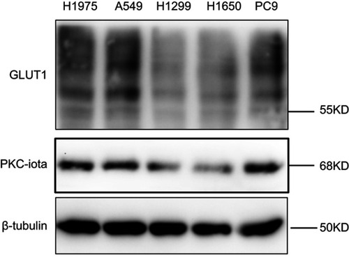 Figure S1 The basal protein levels of GLUT1 and PKC-iota in NSCLC cell lines. NSCLC cells lysates were immunoblotted with indicated antibodies. β-Tubulin served as the loading control