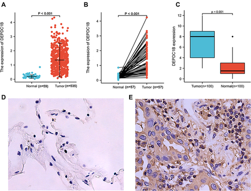 Figure 1 DEPDC1B expression in lung adenocarcinoma (LUAD). (A) DEPDC1B expression levels in LUAD and normal tissues from a TCGA dataset. (B) DEPDC1B expression levels in LUAD and paired normal tissues from a TCGA dataset. (C) Immunohistochemical staining of DEPDC1B in LUAD and adjacent normal lung tissues from 100 patients. Representative IHC images of DEPDC1B expression in normal tissues (D) and LUAD tissues (E).